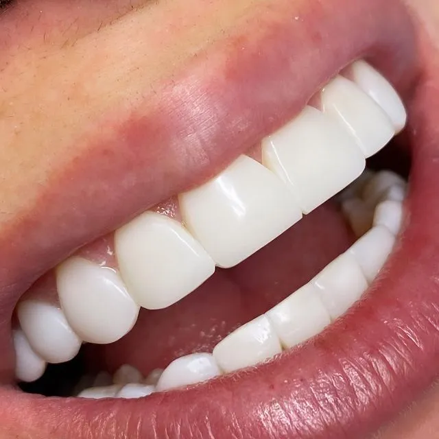 Oral Surgery