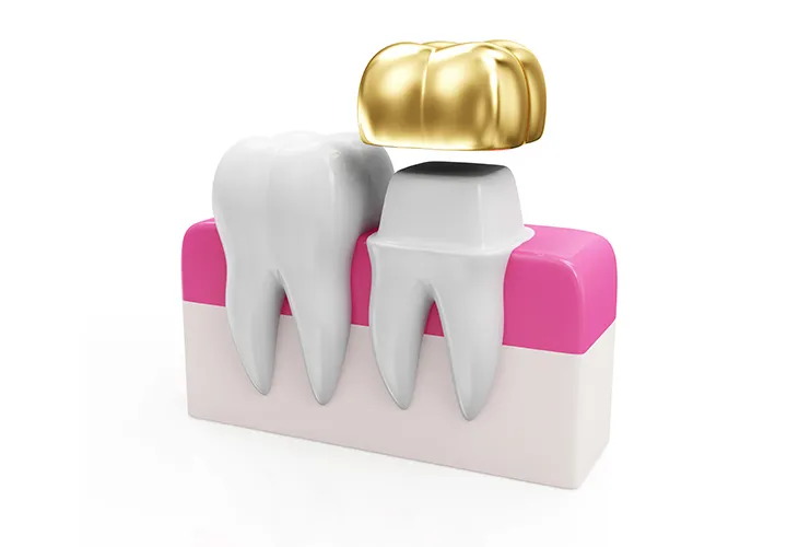 Oral Surgery
